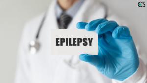 How To Use CBD for Epilepsy