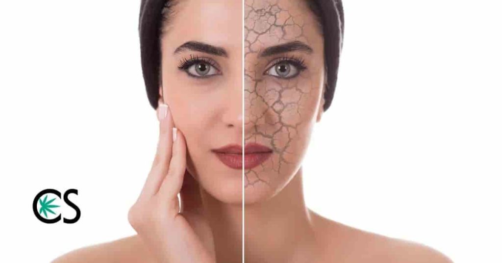 Woman with dry skin before and after